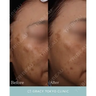 GRACY TOKYO CLINIC【グレイシートウキョウクリニック】の症例