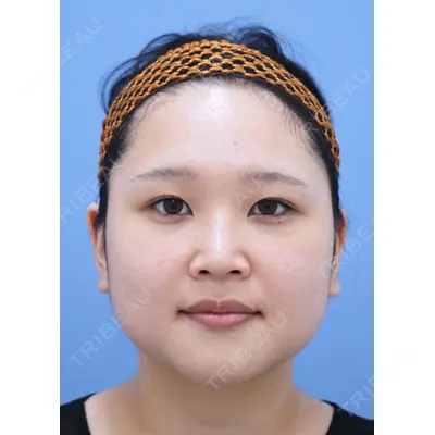 湘南美容クリニック 秋葉原院 名倉 俊輔医師の症例