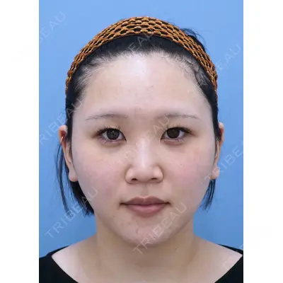 湘南美容クリニック 秋葉原院 名倉 俊輔医師の症例