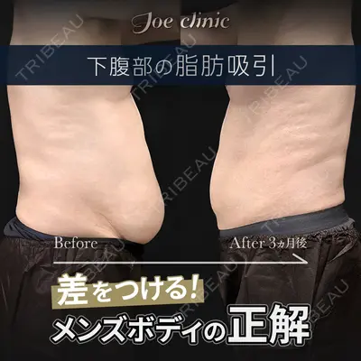 ジョウクリニック 高知院 溝渕　貴俊医師の症例