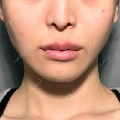 PRISM Beauty Clinic 町田院 森本 理一郎医師の症例