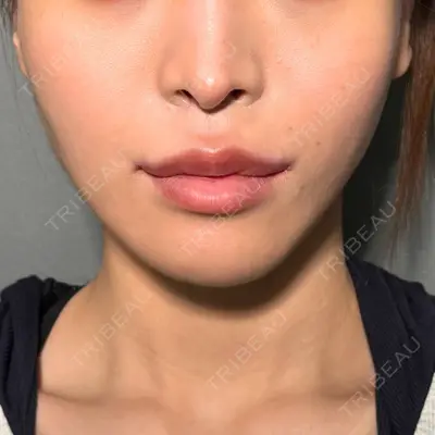 PRISM Beauty Clinic 町田院 森本 理一郎医師の症例