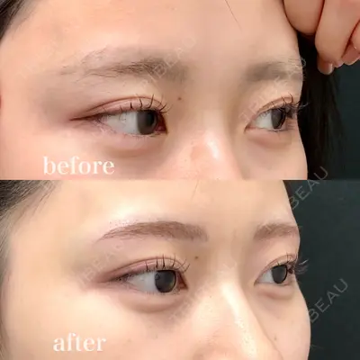 共立美容外科 大分院の症例