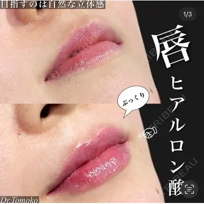 BIANCA表参道 松田 朋子医師の症例