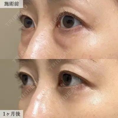 TCB東京中央美容外科 札幌大通院の症例