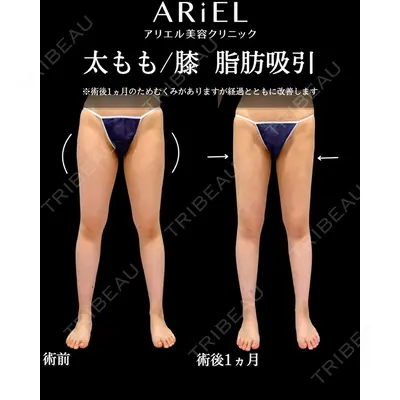 アリエル美容クリニック 横浜院 加藤 敏次医師の症例