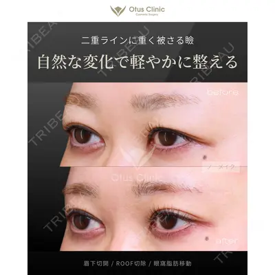 Otus Clinic 【オータスクリニック】 中 徳太郎医師の症例
