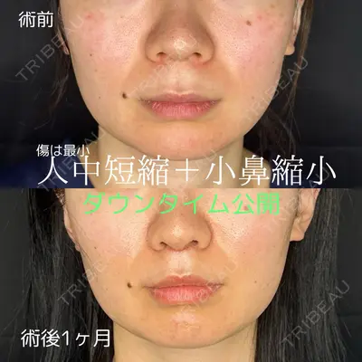 ルラ美容クリニック 仙台院 / ルラスキンクリニック 仙台院 橋本 英樹医師の症例