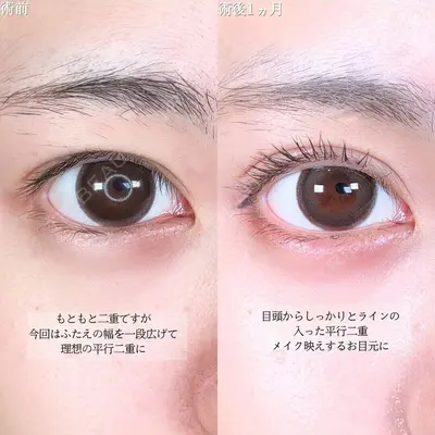 アリエル美容クリニック 大宮院 鈴木　桂介医師の症例
