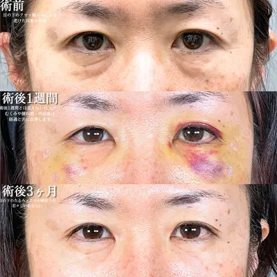 アリエル美容クリニック 横浜院の症例