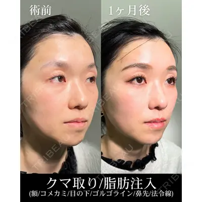 HAAB×DREAM BEAUTY CLINIC 大阪梅田院 鈴木 馨斗医師の症例