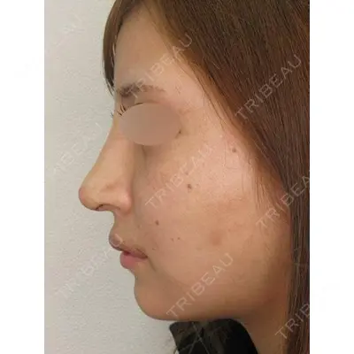 MAe Clinic 東京院 前田 翔医師の症例