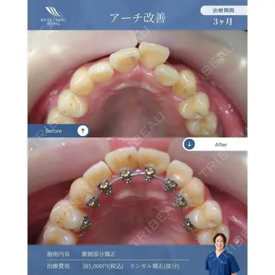 RIVER CLINIC DENTAL 古居 憲医師の症例