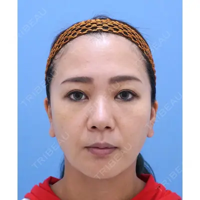 湘南美容クリニック 秋葉原院 名倉 俊輔医師の症例