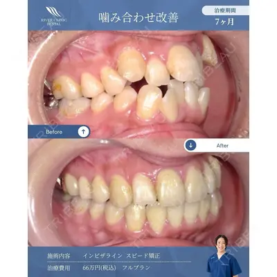 RIVER CLINIC DENTAL 古居 憲医師の症例