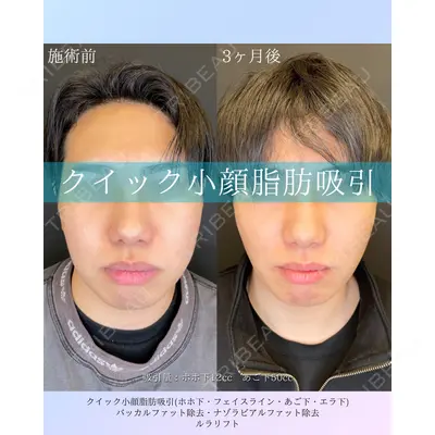 ルラ美容クリニック 札幌本院 佐藤 雄紀医師の症例