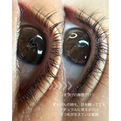 M'sクリニック【エムズクリニック】 永山　詩織（アートメイク施術者）医師の症例