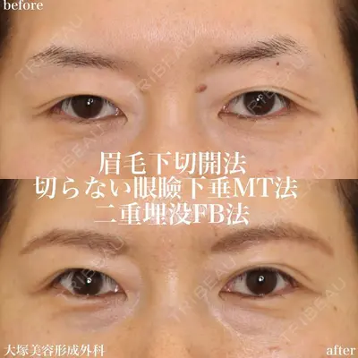 大塚美容形成外科 札幌院の症例