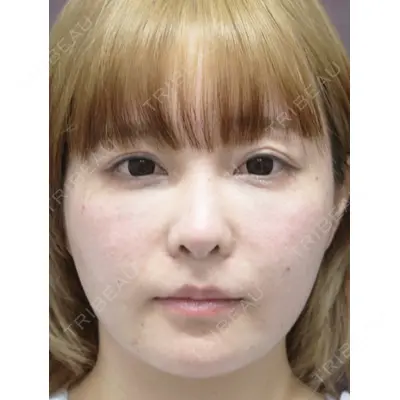 MAe Clinic 東京院 前田 翔医師の症例