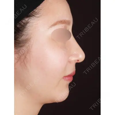 MAe Clinic 東京院 前田 翔医師の症例