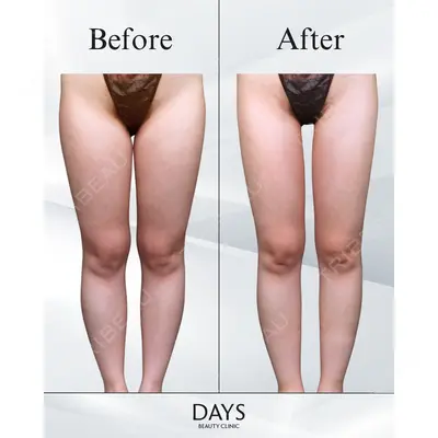 Days Beauty Clinic 本厚木院の症例