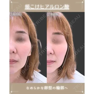 DMTC美容皮膚科 大宮院 村上医師医師の症例