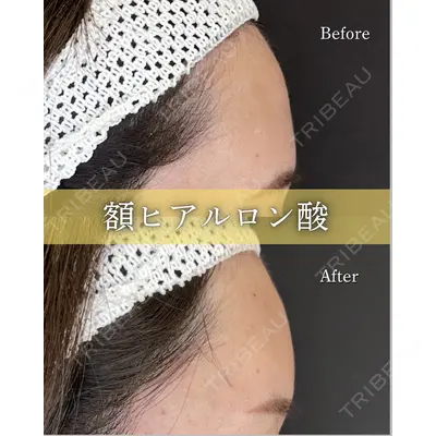 ルラ美容クリニック 京都院 矢田 玲奈医師の症例