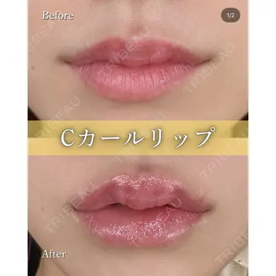 ルラ美容クリニック 京都院 矢田 玲奈医師の症例