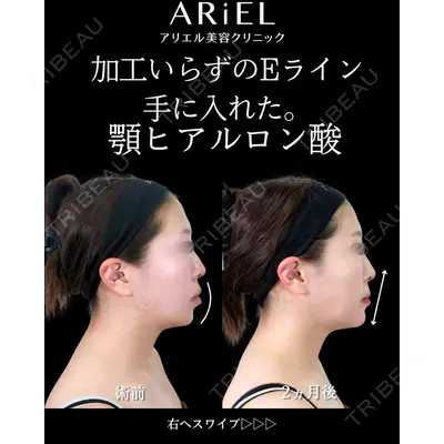 アリエル美容クリニック 大宮院の症例