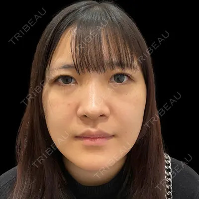 PRISM Beauty Clinic 新宿院 畑山 知輝医師の症例
