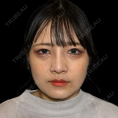 PRISM Beauty Clinic 新宿院 畑山 知輝医師の症例