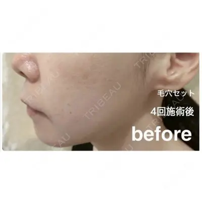 やさしい美容皮膚科・皮フ科　秋葉原院 宇井 千穂医師の症例