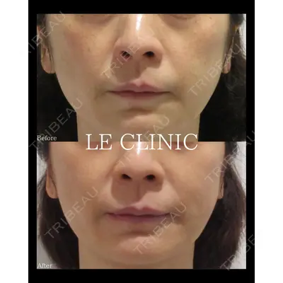 LE CLINICの症例