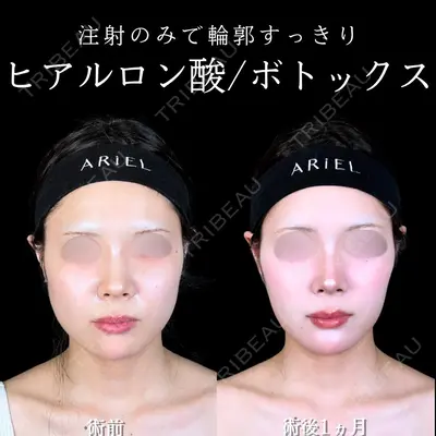 アリエル美容クリニック 大宮院の症例