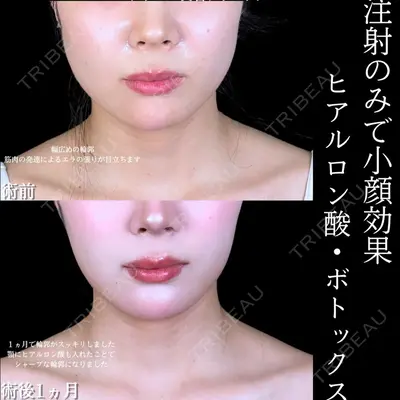 アリエル美容クリニック 大宮院の症例