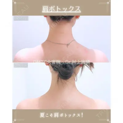 DMTC美容皮膚科 大宮院 村上医師医師の症例