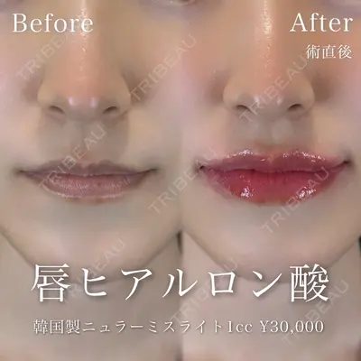 BIJOU CLINICの症例