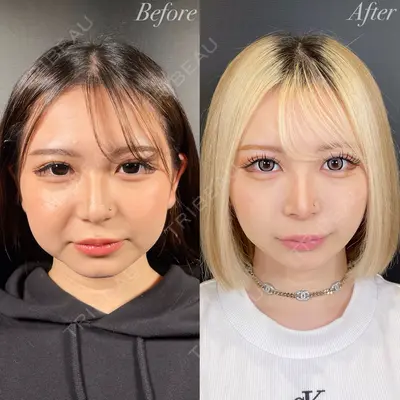 R Beauty CLINIC 銀座院 吉田　慧医師の症例