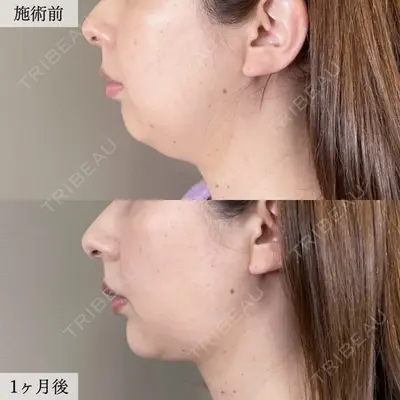 TCB東京中央美容外科 川口院の症例