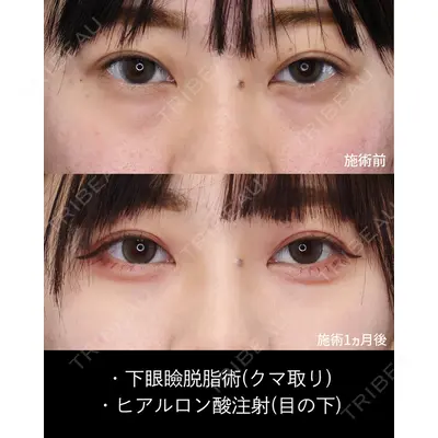 高崎TAクリニック 小林 慧祐医師の症例