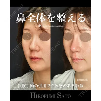 シンデレラ＆ダヴィンチクリニック 佐藤 博文医師の症例