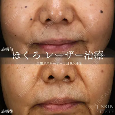 Jスキンクリニック 【J-SKIN clinic】の症例