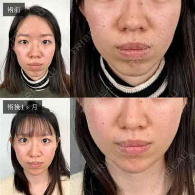 TCB東京中央美容外科 秋田院の症例