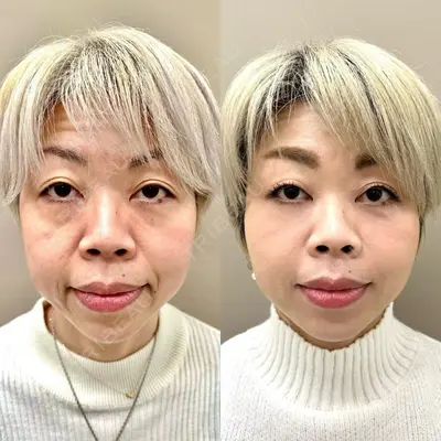 TCB東京中央美容外科 福島院の症例