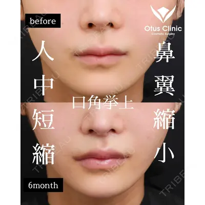 Otus Clinic 【オータスクリニック】 中 徳太郎医師の症例