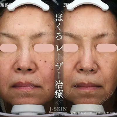 Jスキンクリニック 【J-SKIN clinic】の症例
