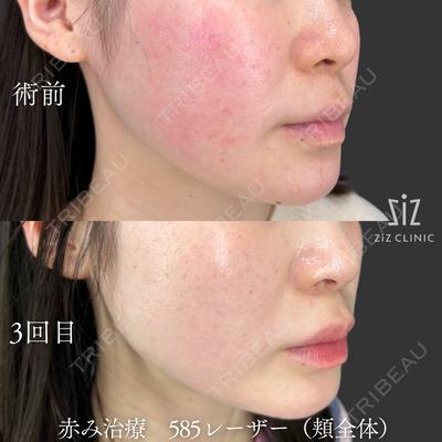 ziz CLINIC 村岡 史子医師の症例