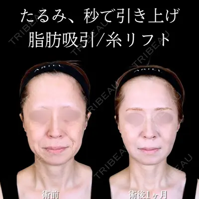 アリエル美容クリニック 大宮院 江郷隼一郎医師の症例