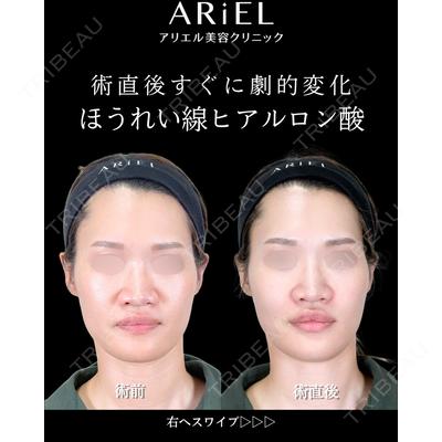 アリエル美容クリニック 横浜院 渡邉 光医師の症例