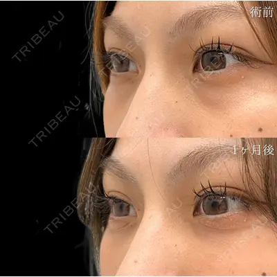 TCB東京中央美容外科 浜松院の症例